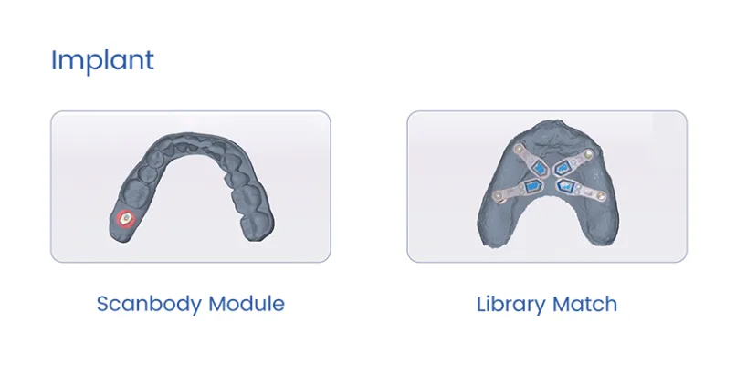 Módulo de implantes del escáner Aidite: Scanbody y Library Match